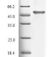 Human Tryptophan 2,3-dioxygenase (TDO2) Recombinant Protein, N-His - BioCrest Sci