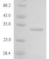 Rat Type-2 angiotensin II receptor (Agtr2), partial Recombinant Protein, N-GST - BioCrest Sci