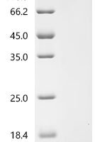 Bovine Insulin-like growth factor I (IGF1) Recombinant Protein, C-His, aa 50–119, Yeast - BioCrest Sci