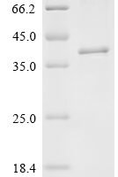 Macaca mulatta Ferric oxidoreductase domain-containing protein (STEAP1) Recombinant Protein - BioCrest Sci