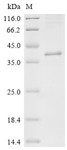 Macaca mulatta Ferric oxidoreductase domain-containing protein (STEAP1) Recombinant Protein, Macaca mulatta (Rhesus macaque), in vitro E.coli expression system, C-terminal 10xHis-tagged, 41.2 kDa, purity >≥ 85% as determined by SDS-PAGE.