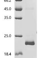 Human Cytochrome c (CYCS) Recombinant Protein, C-His - BioCrest Sci