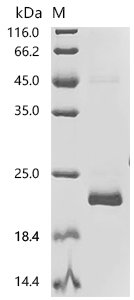 Human Cytochrome c (CYCS) Recombinant Protein, C-His, Homo sapiens (Human), E.coli, C-terminal 6xHis-tagged, 18.5 kDa, purity >≥ 95% as determined by SDS-PAGE.