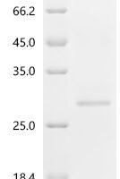 Human Serine/threonine-protein phosphatase PGAM5, mitochondrial (PGAM5), partial Recombinant Protein, C-His, aa 30–289, Yeast - BioCrest Sci
