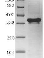 Mouse Interleukin-7 receptor subunit alpha (Il7r), partial Recombinant Protein, N-His-SUMO - BioCrest Sci