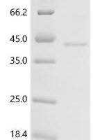 Mouse Inhibin beta E chain (Inhbe) Recombinant Protein, N-hFc - BioCrest Sci
