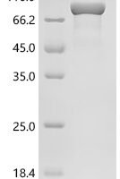 Finegoldia magna ATCC 53516 LPXTG-motif cell wall anchor domain protein, partial,Biotinylated Recombinant Protein - BioCrest Sci