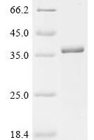 Mouse Mannose-binding protein C (Mbl2) Recombinant Protein - BioCrest Sci