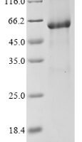 Human Bifunctional 3'-5' exonuclease/ATP-dependent helicase WRN (WRN), partial Recombinant Protein, N-His - BioCrest Sci