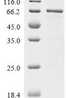 Human Interleukin-23 subunit alpha (IL23A), Biotinylated Recombinant Protein - BioCrest Sci