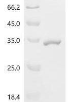 Human Glutathione S-transferase theta-1 (GSTT1) Recombinant Protein - BioCrest Sci