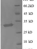 Human Metallothionein-1X (MT1X), partial Recombinant Protein, N-GST - BioCrest Sci