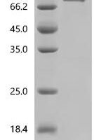 Mouse Nicotinamide phosphoribosyltransferase (Nampt) Recombinant Protein, C-hFc1 - BioCrest Sci