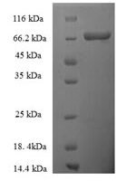 Human Thyroid hormone receptor beta (THRB) Recombinant Protein - BioCrest Sci