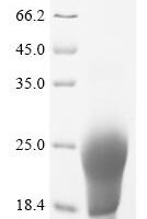 Mycobacterium avium Lipoprotein lpqH (lpqH) Recombinant Protein - BioCrest Sci