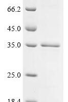 Actinidia deliciosa Actinidain Recombinant Protein - BioCrest Sci