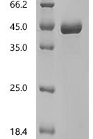 Human Coagulation factor IX (F9), partial Recombinant Protein, C-hFc1 - BioCrest Sci