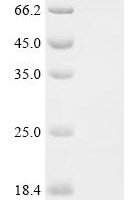 Human REST corepressor 1 (RCOR1), partial,Biotinylated Recombinant Protein - BioCrest Sci
