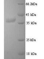 Mouse Tyrosine-protein kinase JAK3 (Jak3), partial Recombinant Protein, N-His, aa 818–1100, Yeast - BioCrest Sci