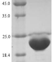 Bovine Odorant-binding protein Recombinant Protein, N-His - BioCrest Sci