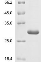 Human Potassium voltage-gated channel subfamily H member 8 (KCNH8), partial Recombinant Protein - BioCrest Sci