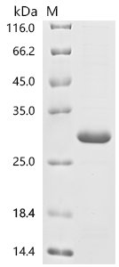Human Potassium voltage-gated channel subfamily H member 8 (KCNH8), partial Recombinant Protein, Homo sapiens (Human), E.coli, N-terminal 6xHis-tagged and C-terminal Flag-tagged, 27.5 kDa, purity >≥ 90% as determined by SDS-PAGE.