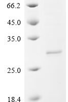 Human IL-12 receptor beta component (IL12RB1), partial Recombinant Protein, C-10His, aa 25–239 - BioCrest Sci