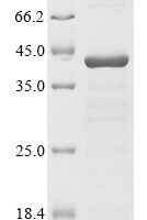 Human Ataxin-2 (ATXN2), partial Recombinant Protein - BioCrest Sci