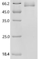 Human Testican-3 (SPOCK3) Recombinant Protein - BioCrest Sci