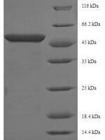 Mouse Phosphoserine aminotransferase (Psat1) Recombinant Protein - BioCrest Sci