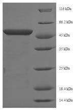 Mouse Phosphoserine aminotransferase (Psat1) Recombinant Protein, Mus musculus (Mouse), E.coli, N-terminal 6xHis-SUMO-tagged, 56.5 kDa, purity >≥ 90% as determined by SDS-PAGE.