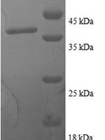 Human Thioredoxin (TXN) Recombinant Protein - BioCrest Sci