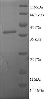 Human Thioredoxin (TXN) Recombinant Protein, Homo sapiens (Human), E.coli, N-terminal GST-tagged, 38.6 kDa, purity >≥ 90% as determined by SDS-PAGE.