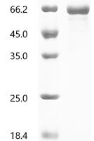 Human E3 ubiquitin-protein ligase TRIM65 (TRIM65) Recombinant Protein - BioCrest Sci