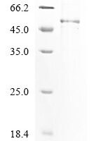 Tobacco mosaic virus Replicase large subunit, partial Recombinant Protein, N-His - BioCrest Sci