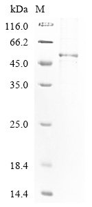 Tobacco mosaic virus Replicase large subunit, partial Recombinant Protein, N-His, Tobacco mosaic virus (strain OM) (TMV), E.coli, N-terminal 6xHis-tagged, 53.9 kDa, purity >≥ 85% as determined by SDS-PAGE.
