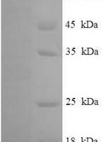 Human Tektin-5 (TEKT5) Recombinant Protein - BioCrest Sci