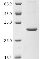 Human Cancer/testis antigen 1 (CTAG1A) Recombinant Protein, C-His - BioCrest Sci