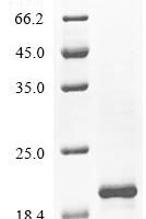 Human Cell migration-inducing and hyaluronan-binding protein(CEMIP), partial Recombinant Protein - BioCrest Sci