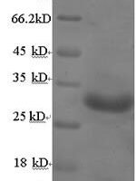 Bordetella pertussis Pertussis toxin subunit 1 (ptxA) Recombinant Protein, N-His, aa 35–269, E.coli - BioCrest Sci