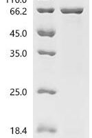 Human NADPH-dependent diflavin oxidoreductase 1 (NDOR1) Recombinant Protein - BioCrest Sci