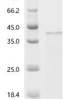 Human metapneumovirus Major surface glycoprotein G (G), partial Recombinant Protein, C-His, aa 52–219, E.coli - BioCrest Sci