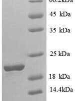 Human Solute carrier family 41 member 2 (SLC41A2), partial Recombinant Protein - BioCrest Sci