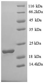 Human Solute carrier family 41 member 2 (SLC41A2), partial Recombinant Protein, Homo sapiens (Human), E.coli, N-terminal 6xHis-tagged, 22.0 kDa, purity >≥ 90% as determined by SDS-PAGE.
