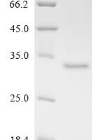 Mouse Complement C1q tumor necrosis factor-related protein 6 (C1qtnf6) Recombinant Protein, C-His - BioCrest Sci