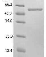 Mouse Cytoskeleton-associated protein 4 (Ckap4), partial Recombinant Protein, N-10His/C-Myc, aa 109–575, E.coli - BioCrest Sci