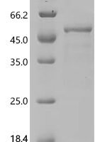 Human V-type proton ATPase subunit C 1 (ATP6V1C1) Recombinant Protein, N-His, aa 2–382, E.coli - BioCrest Sci