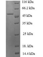 Bacillus subtilis Malate dehydrogenase (mdh) Recombinant Protein - BioCrest Sci