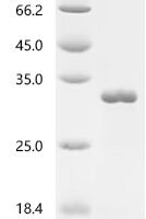 Arabidopsis thaliana Transcription factor TCP21 (TCP21) Recombinant Protein - BioCrest Sci