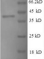 Mycobacterium tuberculosis Peptidoglycan-binding protein ArfA (arfA) Recombinant Protein - BioCrest Sci